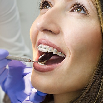 Orthodontist checking patient's adult orthodontics