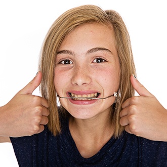 Preteen girl with headgear giving two thumbs up