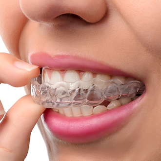 Closeup of patient removing Invisalign tray