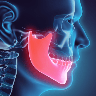 3 D animation of jaw and skull bone used for dentofacial orthopedics treatment planning