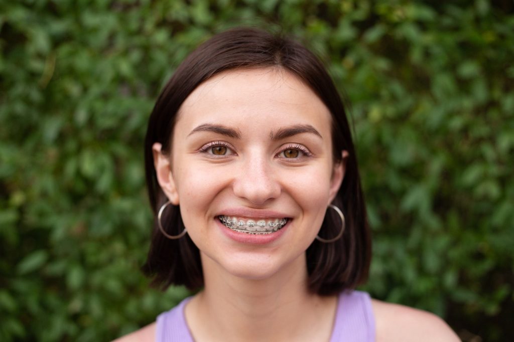 Closeup of woman with traditional braces smiling