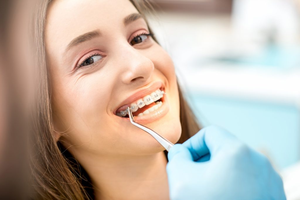 Orthodontist putting braces on patient's teeth